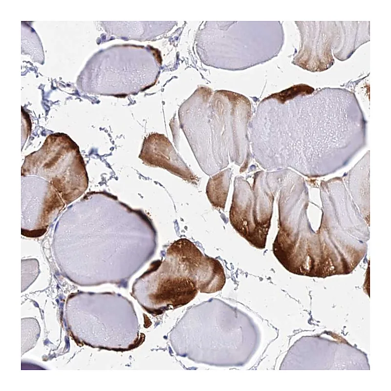 Atlas Antibodies Anti-B3GALT4 Antibody