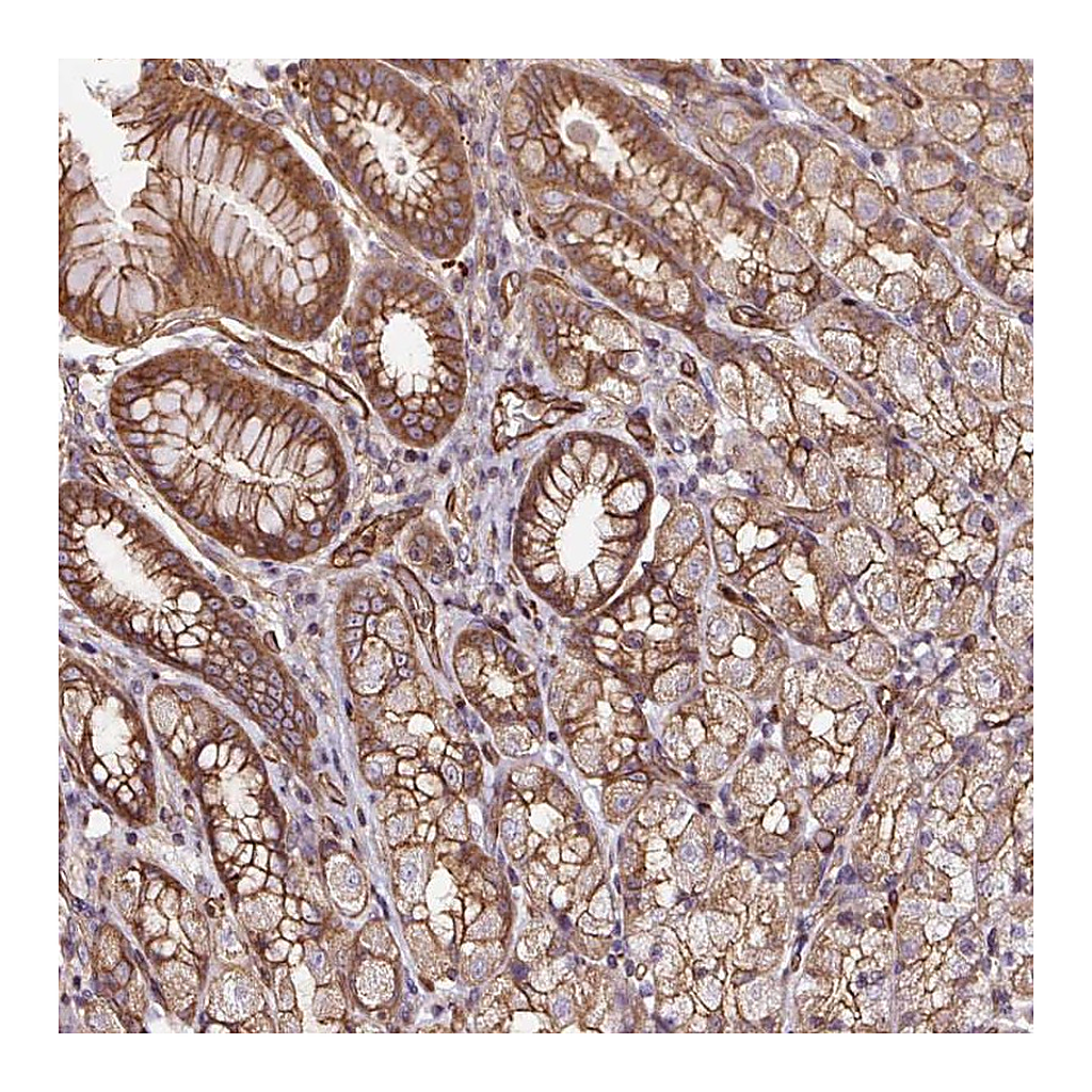 Atlas Antibodies Anti-B3GALT5 Antibody