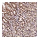 Atlas Antibodies Anti-B3GALT5 Antibody