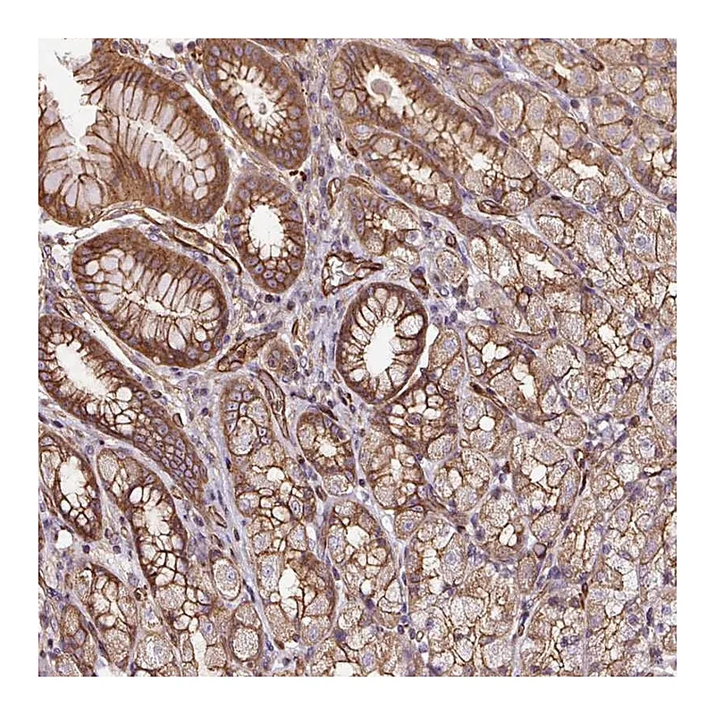 Atlas Antibodies Anti-B3GALT5 Antibody