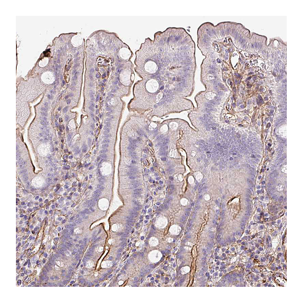 Atlas Antibodies Anti-B3GALT5 Antibody