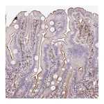 Atlas Antibodies Anti-B3GALT5 Antibody