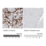 Atlas Antibodies Anti-B3GNT3 Antibody