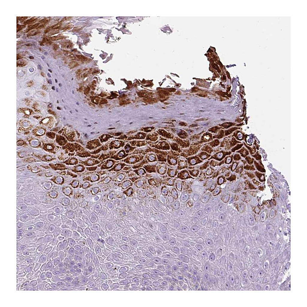 Atlas Antibodies Anti-B3GNT4 Antibody