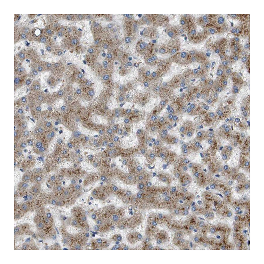 Atlas Antibodies Anti-B3GNT5 Antibody
