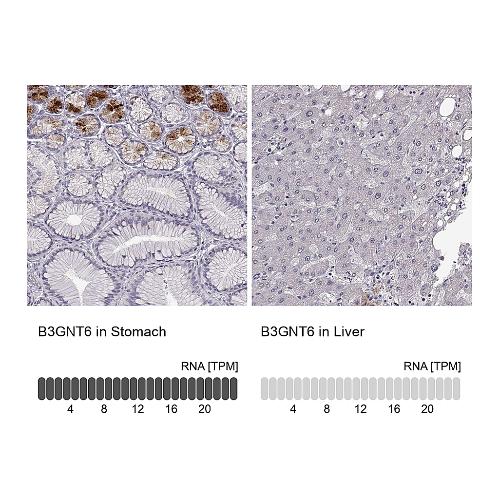 Atlas Antibodies Anti-B3GNT6 Antibody