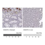 Atlas Antibodies Anti-B3GNT6 Antibody