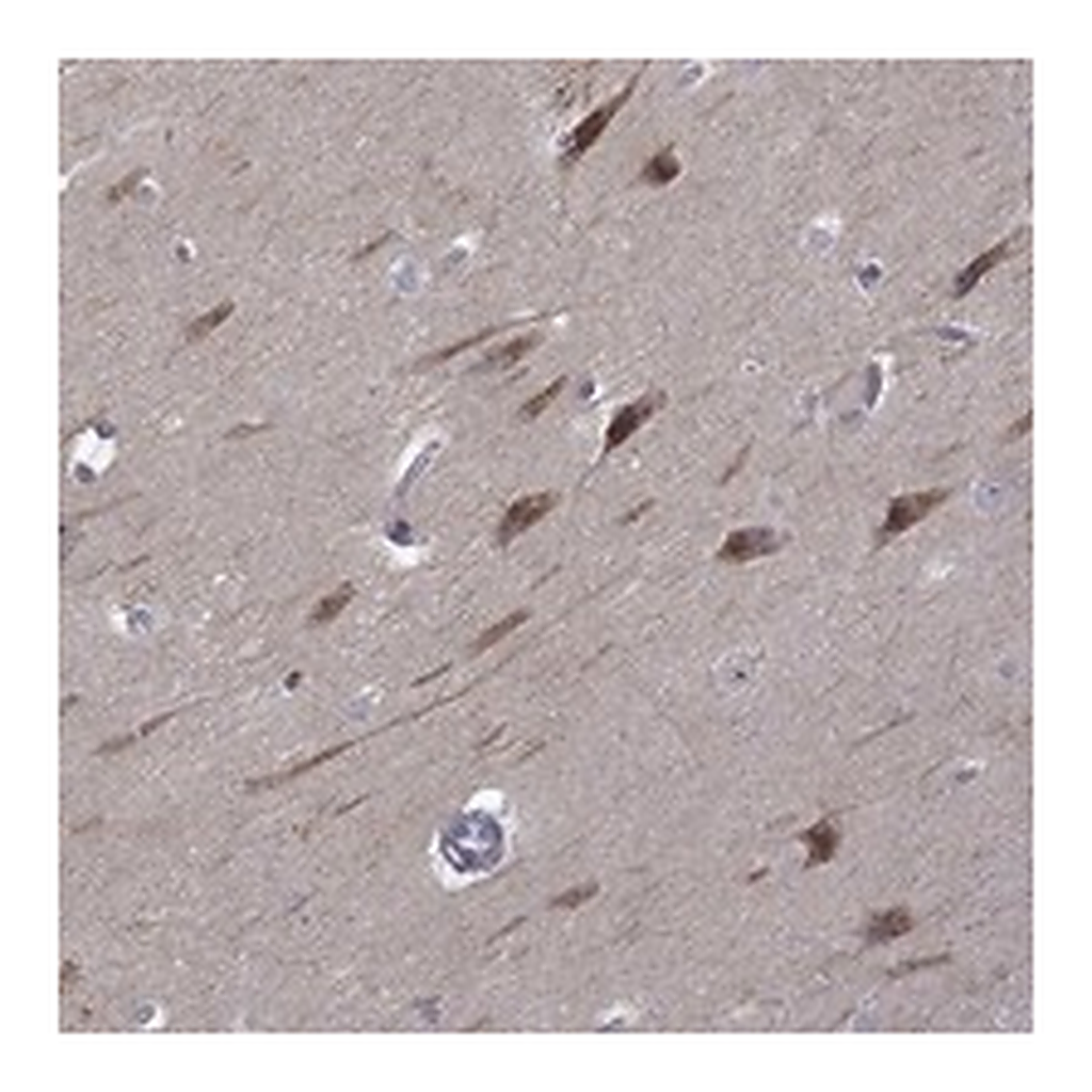 Atlas Antibodies Anti-B3GAT1 Antibody