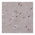 Atlas Antibodies Anti-B3GAT1 Antibody