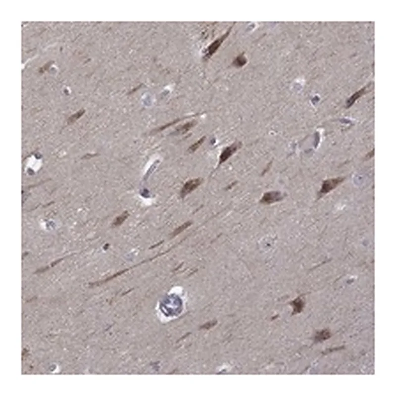 Atlas Antibodies Anti-B3GAT1 Antibody