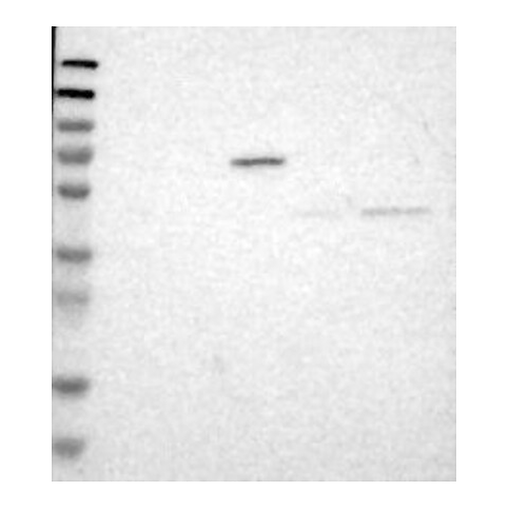 Atlas Antibodies Anti-B3GNT7 Antibody