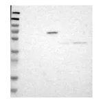Atlas Antibodies Anti-B3GNT7 Antibody