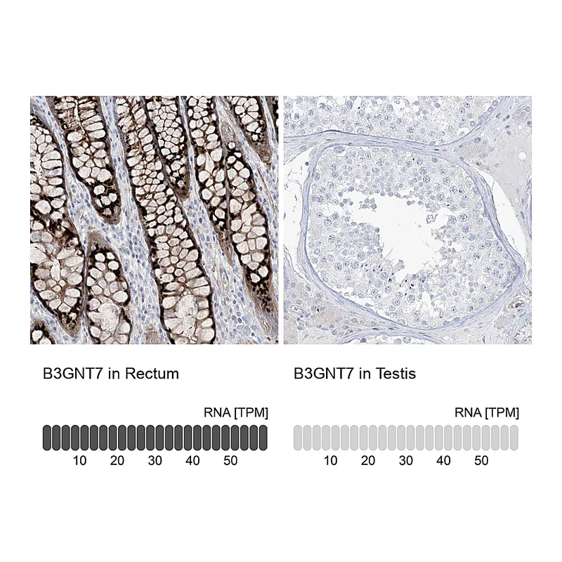 Atlas Antibodies Anti-B3GNT7 Antibody