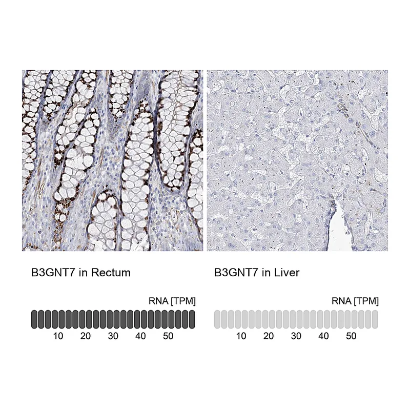Atlas Antibodies Anti-B3GNT7 Antibody