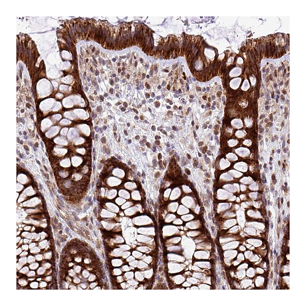 Atlas Antibodies Anti-B3GNT9 Antibody