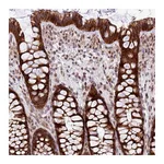 Atlas Antibodies Anti-B3GNT9 Antibody