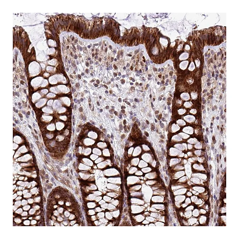 Atlas Antibodies Anti-B3GNT9 Antibody