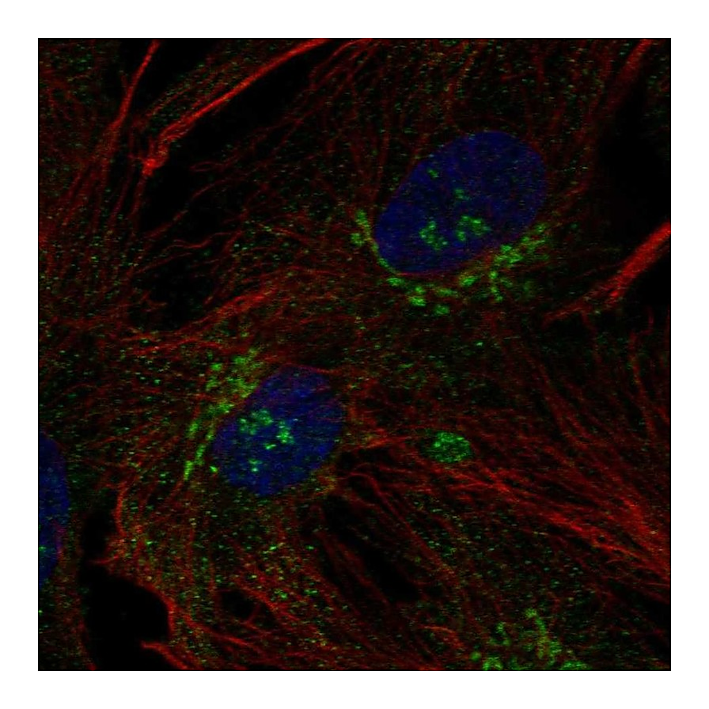 Atlas Antibodies Anti-B3GNT9 Antibody
