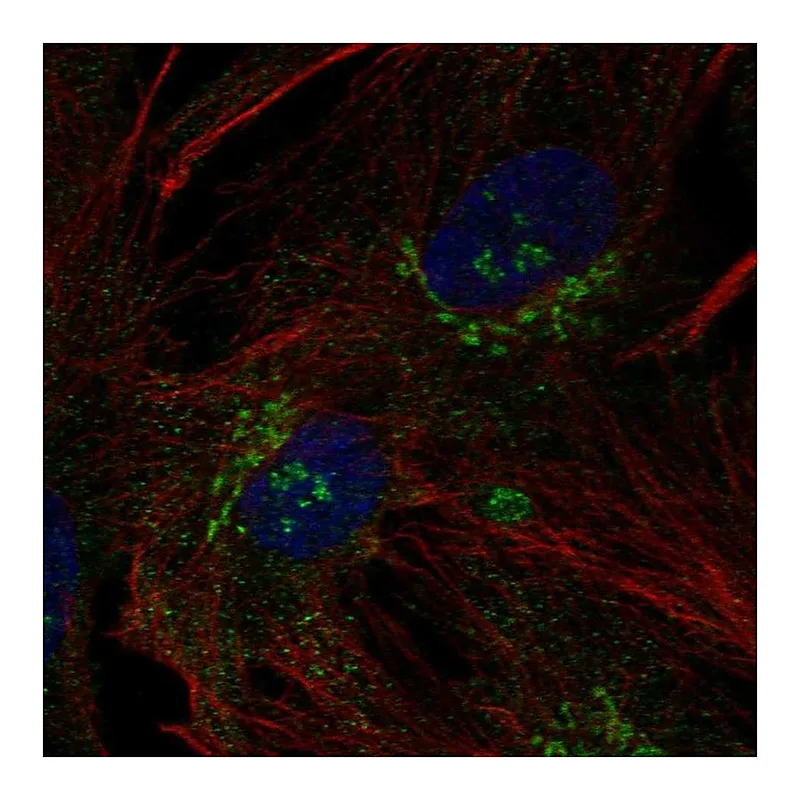Atlas Antibodies Anti-B3GNT9 Antibody