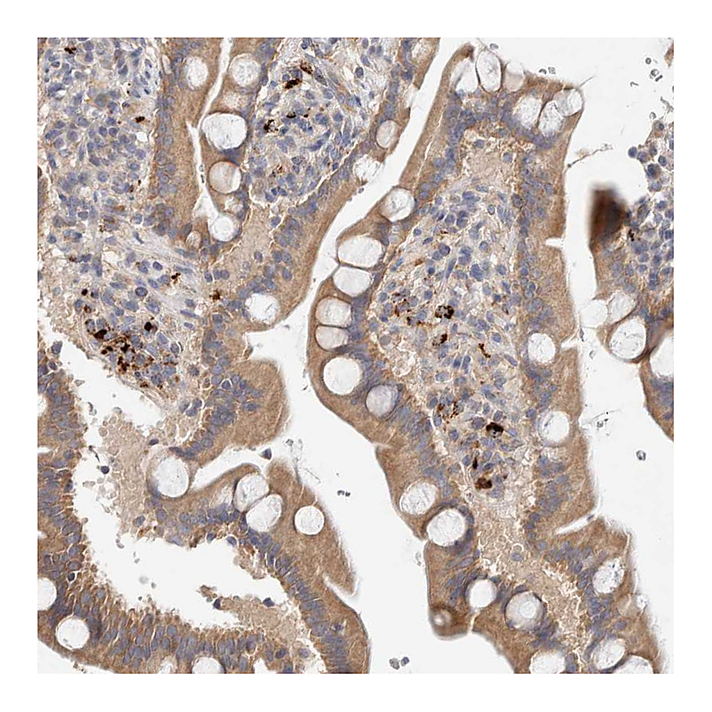 Atlas Antibodies Anti-B3GNTL1 Antibody