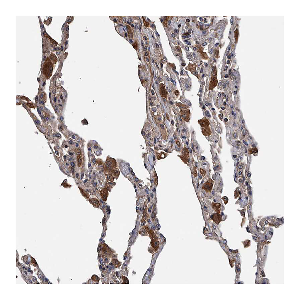 Atlas Antibodies Anti-B3GNTL1 Antibody