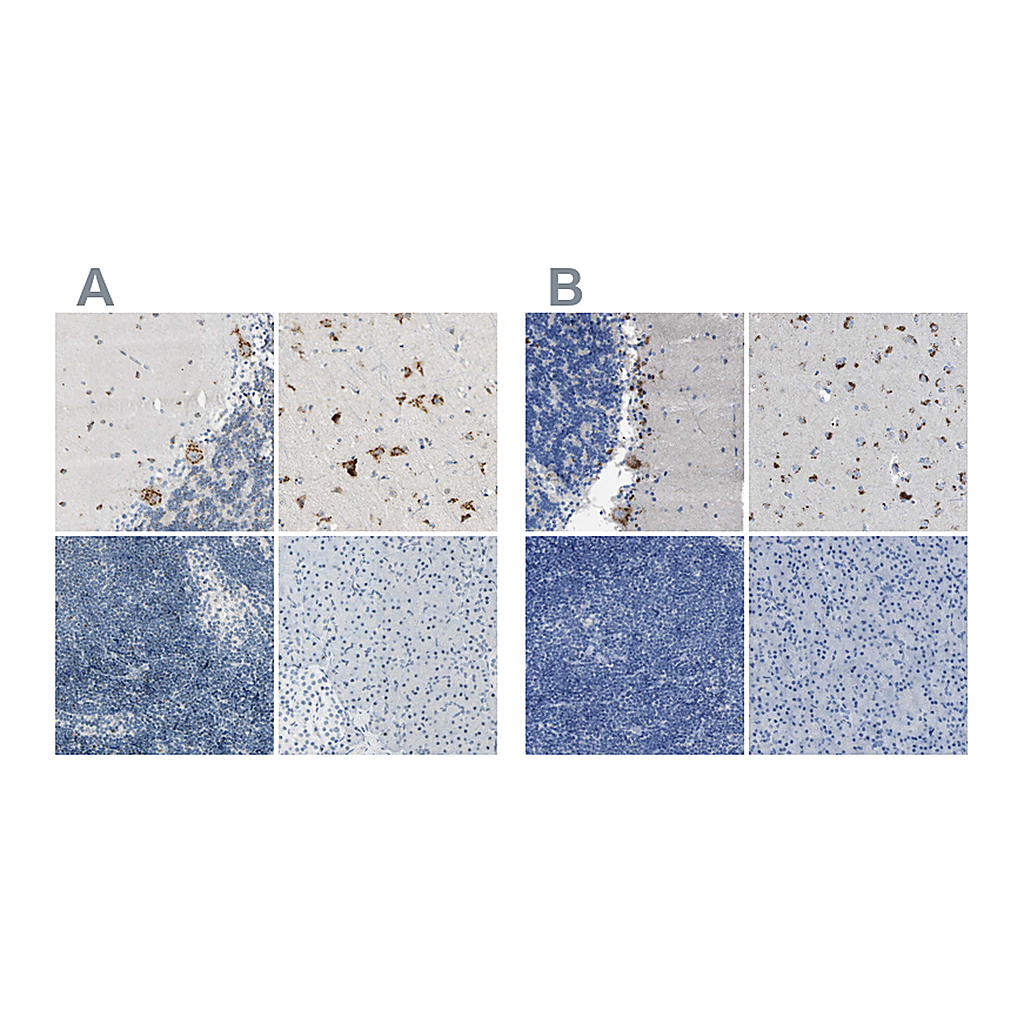 Atlas Antibodies Anti-B4GALNT1 Antibody