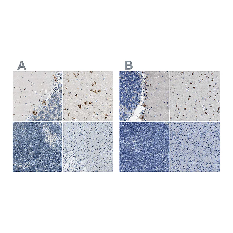 Atlas Antibodies Anti-B4GALNT1 Antibody