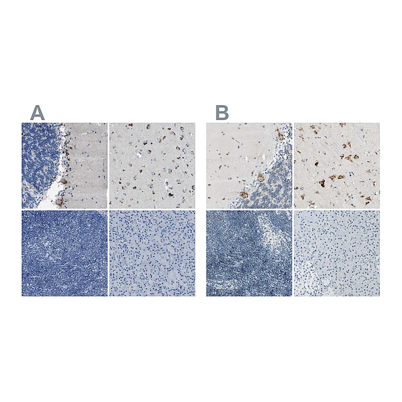 Atlas Antibodies Anti-B4GALNT1 Antibody