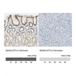 Atlas Antibodies Anti-B4GALNT3 Antibody