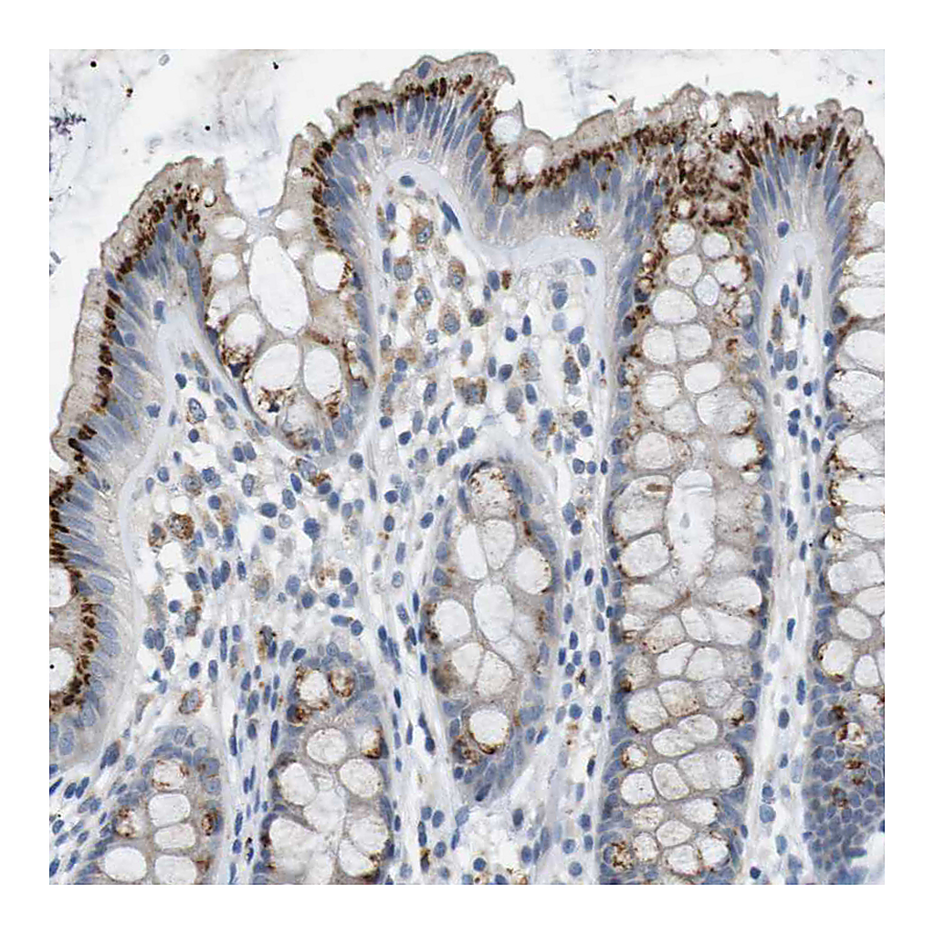 Atlas Antibodies Anti-B4GALNT2 Antibody