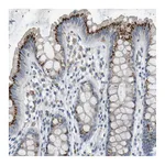 Atlas Antibodies Anti-B4GALNT2 Antibody