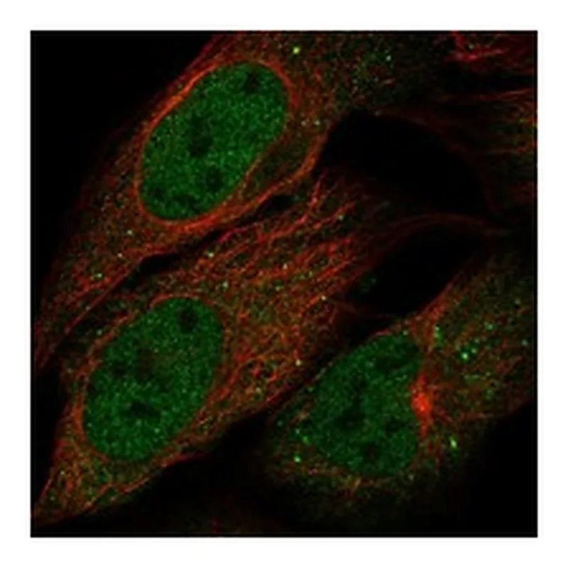Atlas Antibodies Anti-B4GALNT4 Antibody