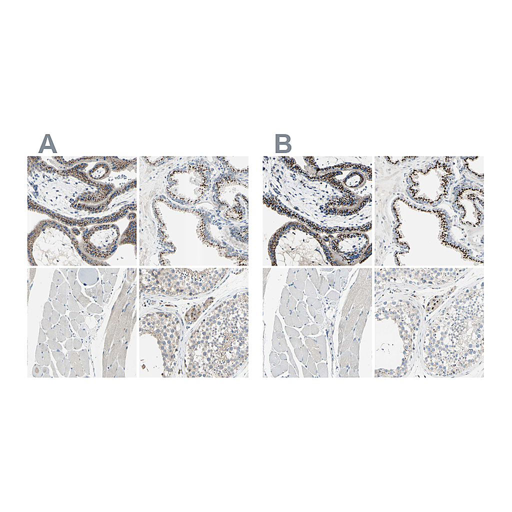 Atlas Antibodies Anti-B4GALT1 Antibody