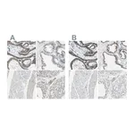 Atlas Antibodies Anti-B4GALT1 Antibody