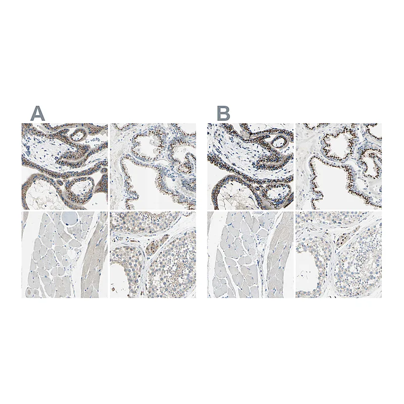 Atlas Antibodies Anti-B4GALT1 Antibody