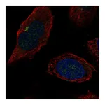 Atlas Antibodies Anti-B4GALT2 Antibody