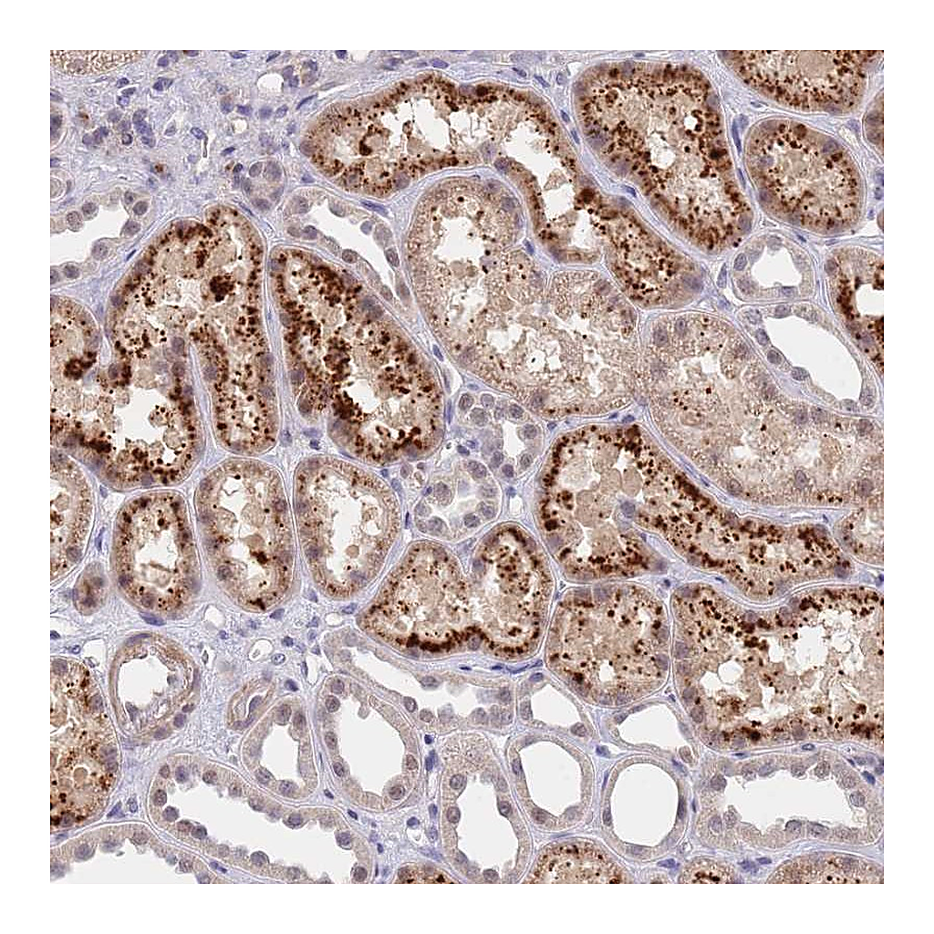 Atlas Antibodies Anti-B4GALT4 Antibody