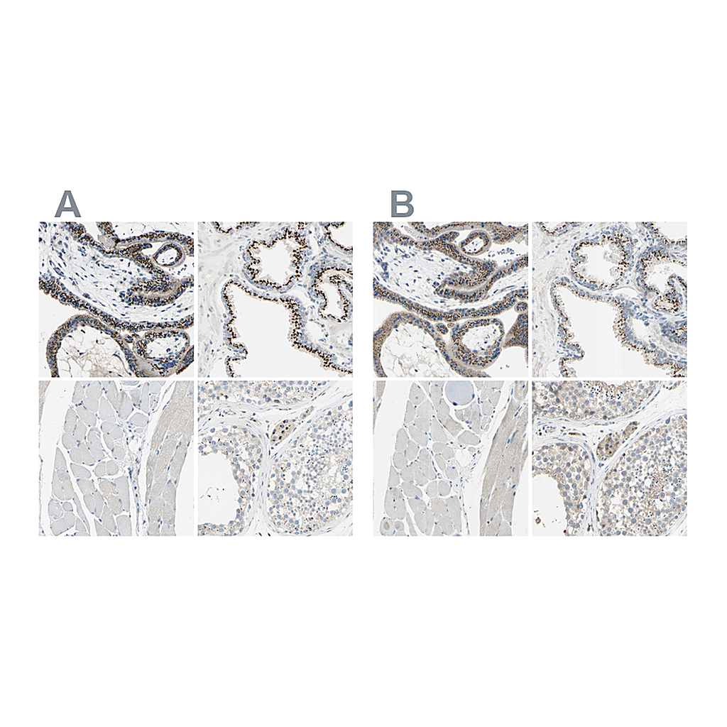 Atlas Antibodies Anti-B4GALT1 Antibody