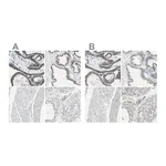 Atlas Antibodies Anti-B4GALT1 Antibody