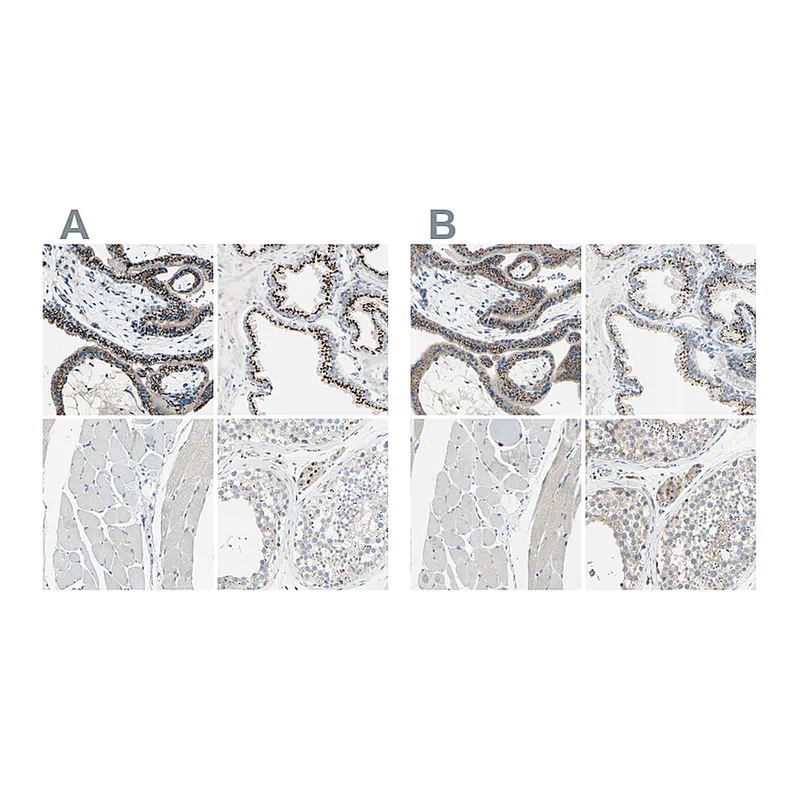 Atlas Antibodies Anti-B4GALT1 Antibody