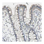 Atlas Antibodies Anti-B4GALT3 Antibody