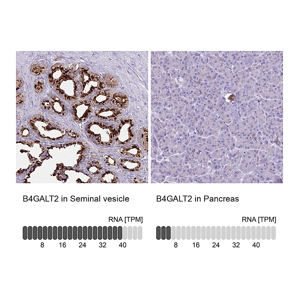 Atlas Antibodies Anti-B4GALT2 Antibody