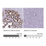 Atlas Antibodies Anti-B4GALT2 Antibody