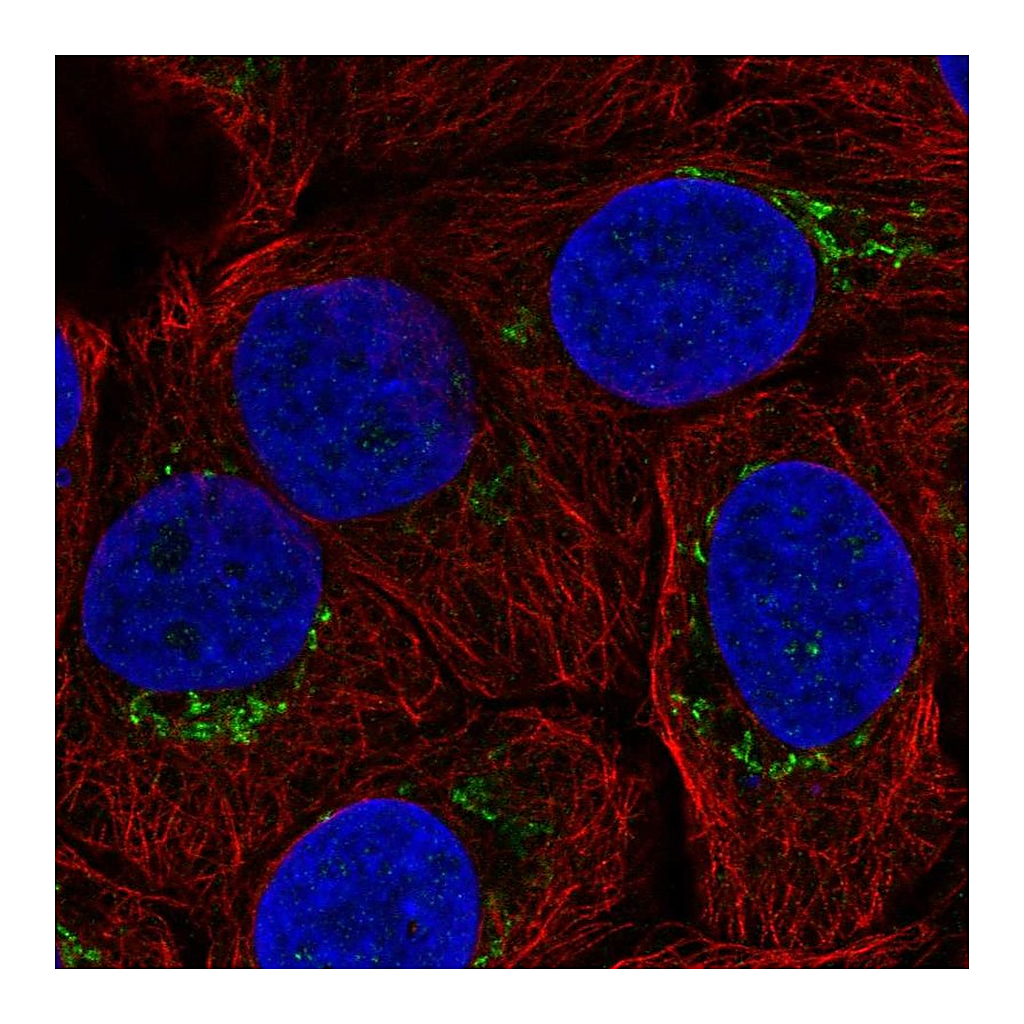 Atlas Antibodies Anti-B4GALT4 Antibody