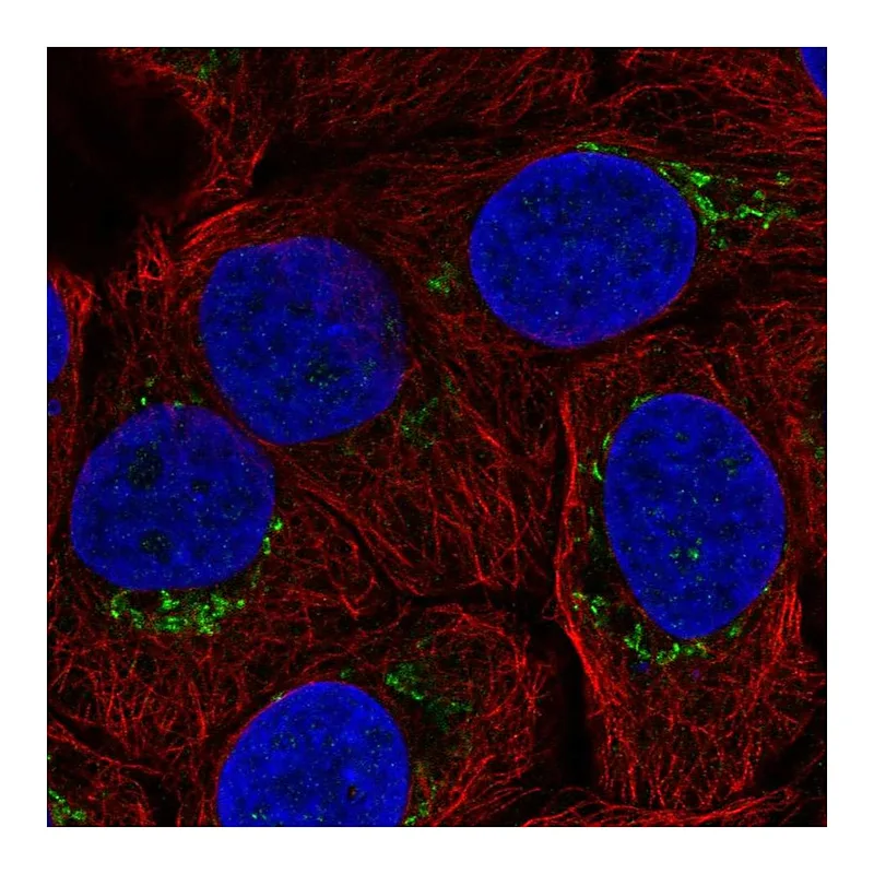 Atlas Antibodies Anti-B4GALT4 Antibody