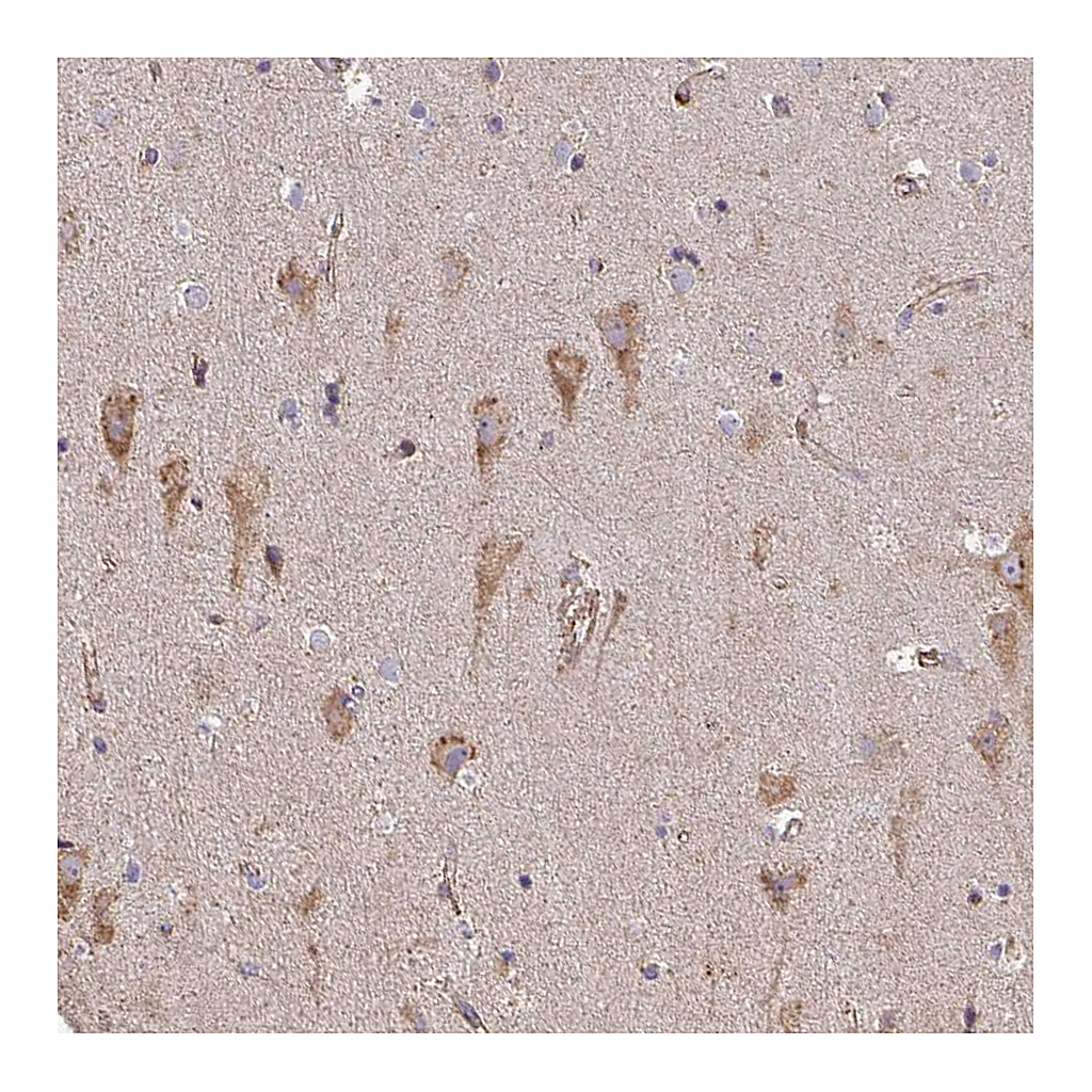 Atlas Antibodies Anti-B4GALT6 Antibody