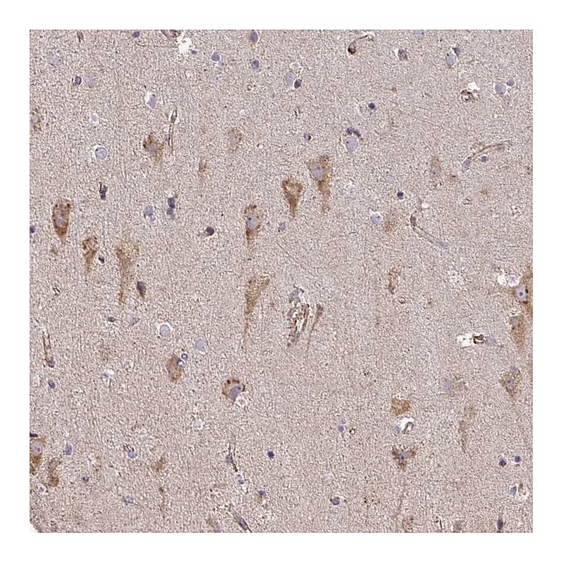Atlas Antibodies Anti-B4GALT6 Antibody