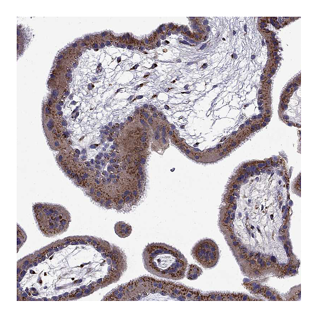 Atlas Antibodies Anti-B4GALT7 Antibody