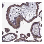 Atlas Antibodies Anti-B4GALT7 Antibody