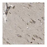 Atlas Antibodies Anti-B4GAT1 Antibody